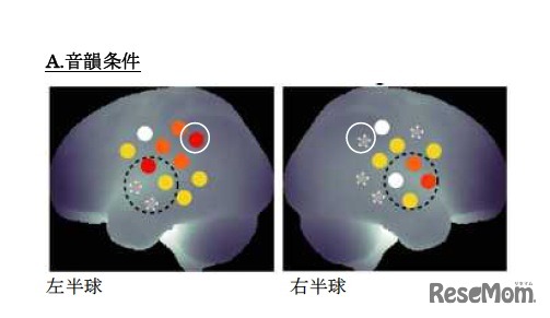 音韻条件