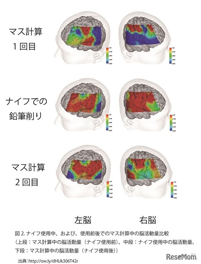 ナイフ使用中、および使用前後でのマス計算中の脳活動量比較（上段：マス計算中の脳活動量／ナイフ使用前、中段：ナイフ使用中の脳活動量、下段：マス計算中の脳活動量／ナイフ使用後）