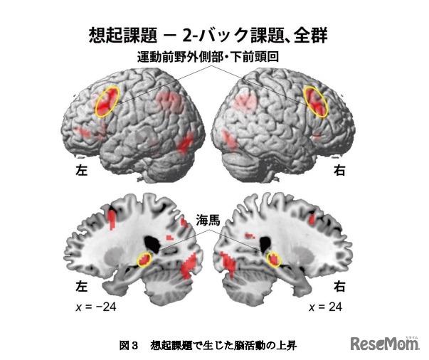 想起課題で生じた脳活動の上昇