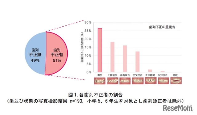 各歯列不正者の割合