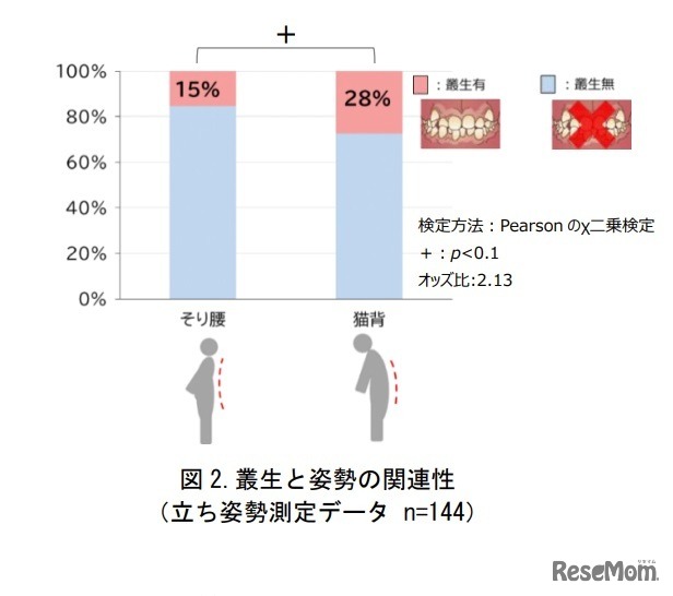 叢生と姿勢の関連性