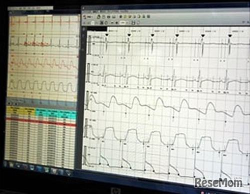 心臓電気生理学解析システム